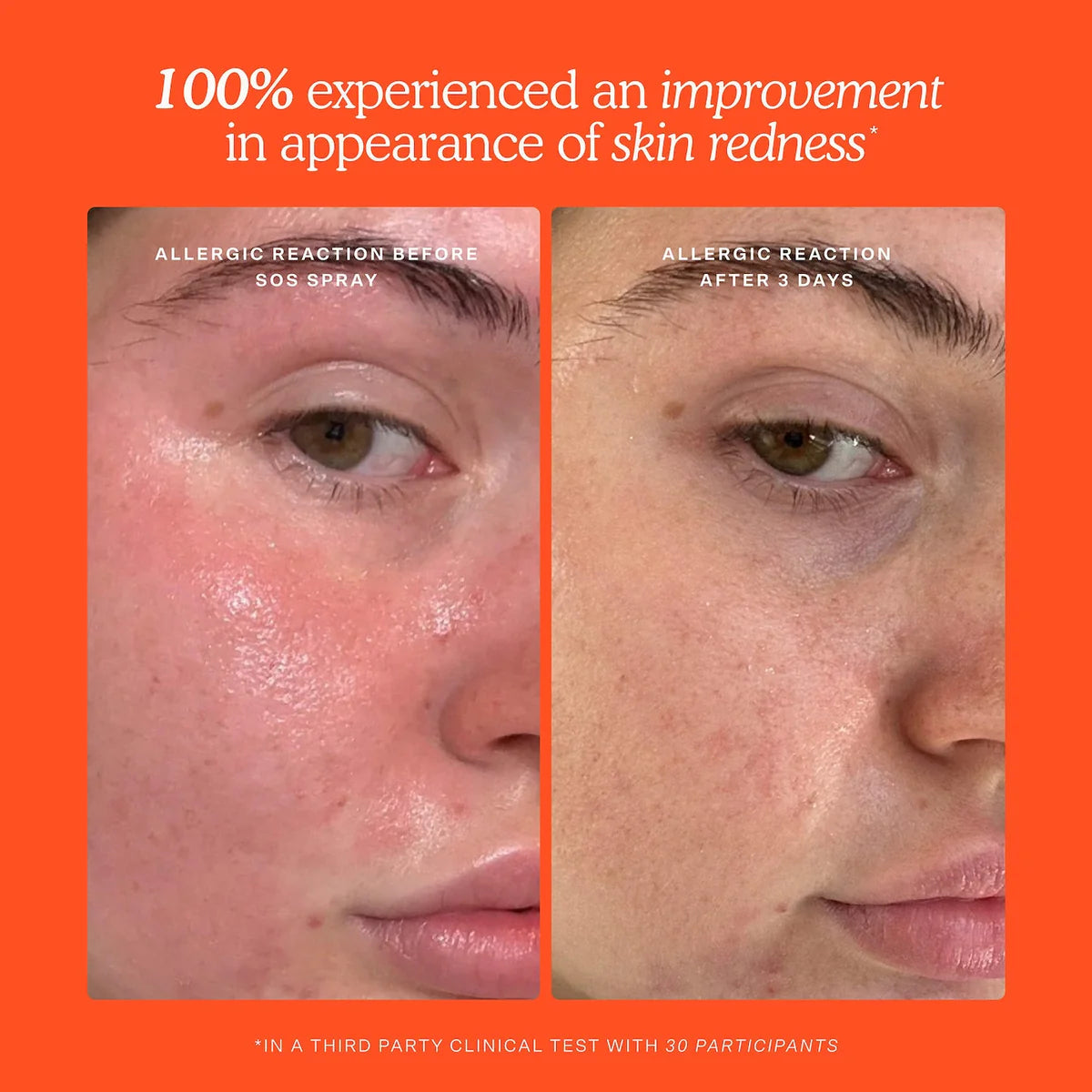 Set Tower 28 Para El Cuidado De La Piel SOS